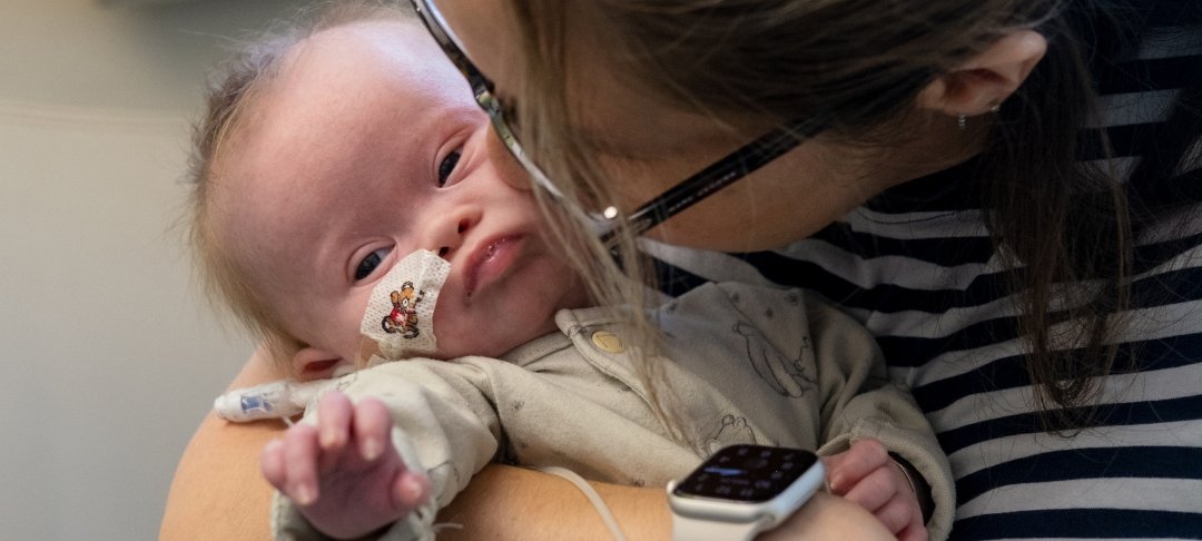 GOSH mum holds her baby daughter and kisses her on the cheek. Baby has a feeding tube attached to her nose.