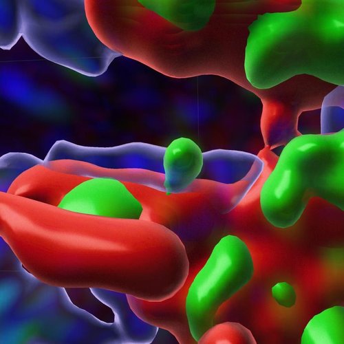 inside of a cell where the WIPI4 protein has been depleted