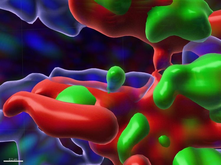 inside of a cell where the WIPI4 protein has been depleted