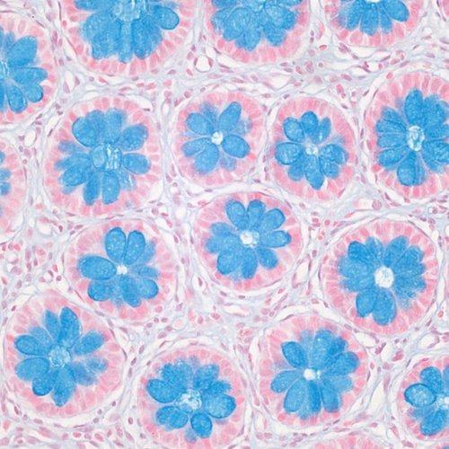 Winner of the 2025 GOSH research image competition. This floral image shows the colon of a patient with Hirschsprung disease, a rare childhood bowel disease.