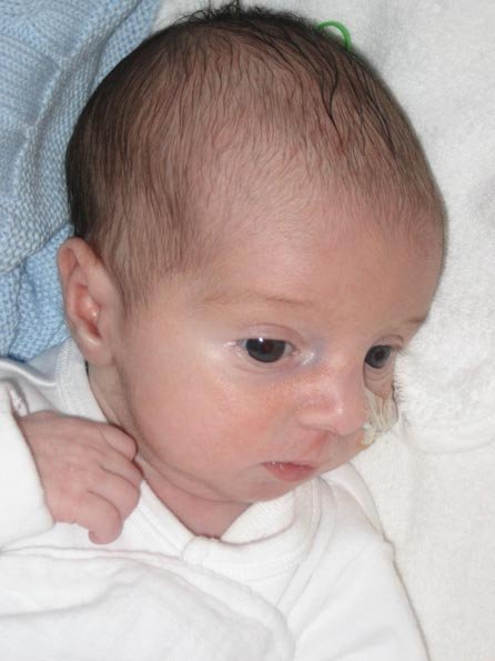 A baby boy with a feeding tube looking around him