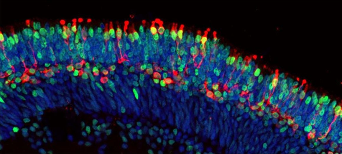 picture showing rod cells