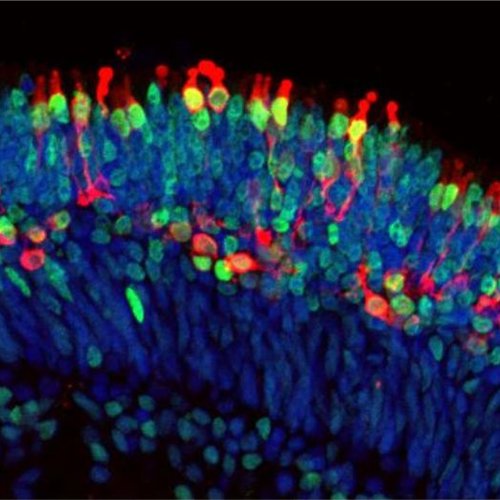 picture showing rod cells