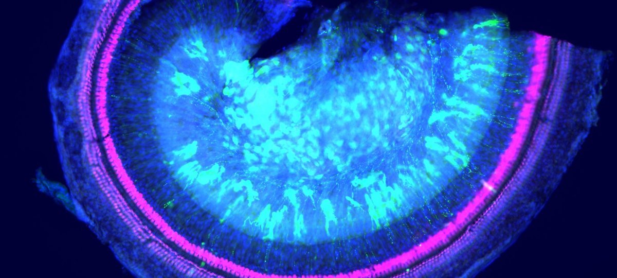Image of part of the uncoiled mouse cochlea after treatment with gene therapy and in pink are the sensory hair cells which preserve hearing in mice with Norrie disease