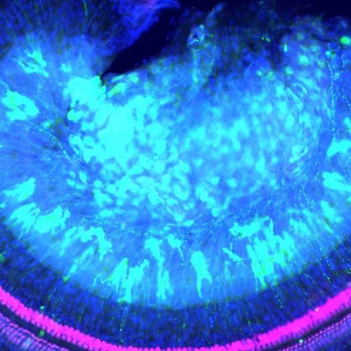 Image of part of the uncoiled mouse cochlea after treatment with gene therapy and in pink are the sensory hair cells which preserve hearing in mice with Norrie disease