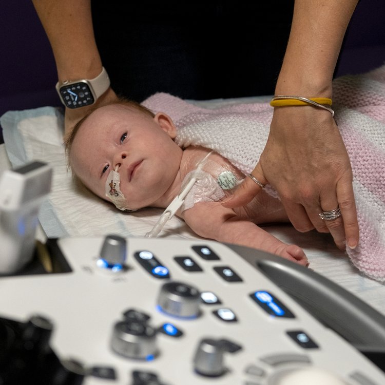 Baby GOSH patient undergoing checks at GOSH. She is facing towards the camera and has a feeding tube attached to her nose.