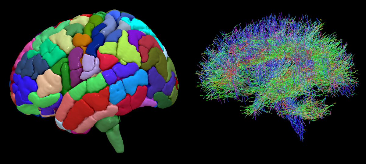 Structural imagine of the brain’s regions (left) and diffusion diagram of the wiring of a brain (right), which Aswin Chari and his team analyse together to create a ’network’