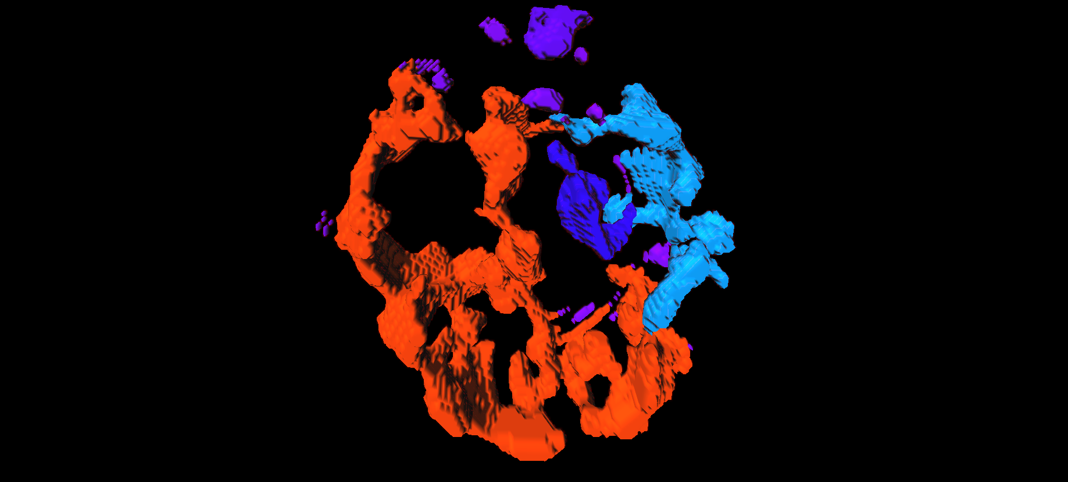 Image showing mitochondria from a patient with JDM