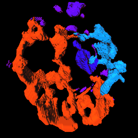Image showing mitochondria from a patient with JDM