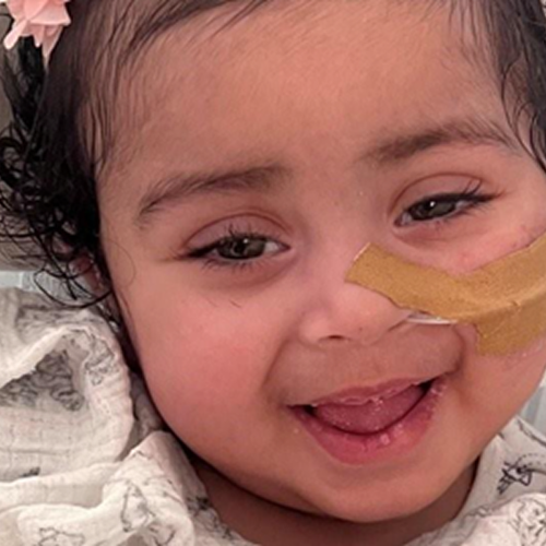 Little girl with tube in nose smiling to camera